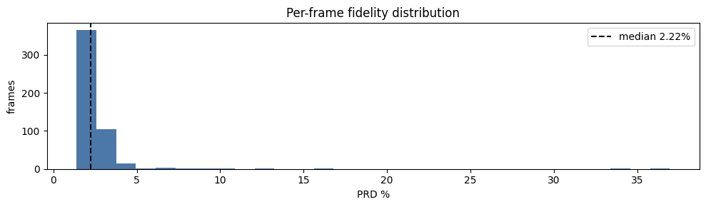 Histogram of per-frame PPG percentage root-mean-square difference (PRD). Horizontal axis: PRD percent; vertical axis: frame count. A dashed line marks the median.