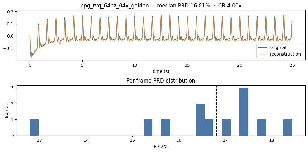 Two panels: original and reconstructed signal over time in seconds, followed by a histogram of per-frame PRD percent with a dashed median line. Histogram vertical axis: frame count.