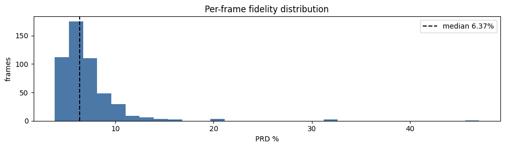 Histogram of per-frame ECG percentage root-mean-square difference (PRD). Horizontal axis: PRD percent; vertical axis: frame count. A dashed line marks the median.