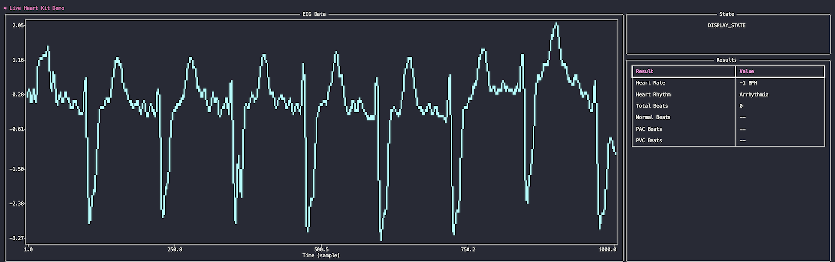 evb-demo-plot